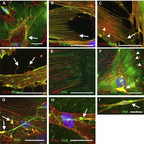 Figure From Hyaluronan Controls The Deposition Of Fibronectin And