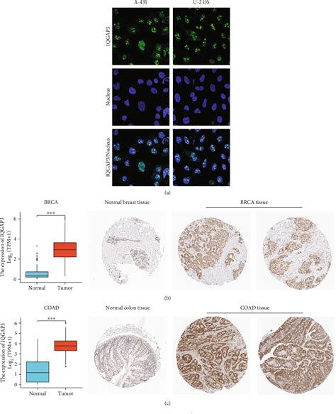 Figure 1 From Comprehensive Multiomics Analysis Identified Iqgap3 As A