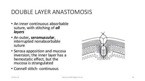 Principles Of Bowel Anastomosis