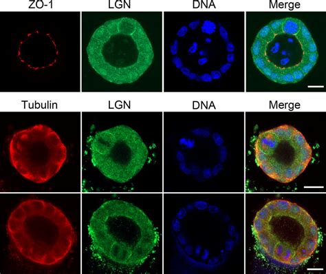 Lgn Is Enriched At The Lateral Cortex Of Mitotic Mdck Cells During