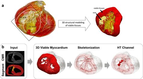 A A 3d Volume Rendered View Of The 3d Ex Vivo Cardiovascular Magnetic