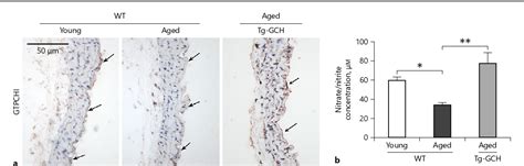 Figure 1 From Endothelium Specific GTP Cyclohydrolase I Overexpression