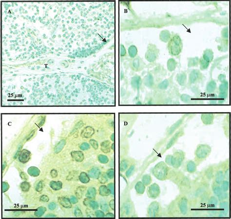 Representative Immunohistochemistry To Detect The Expression Of Meprin