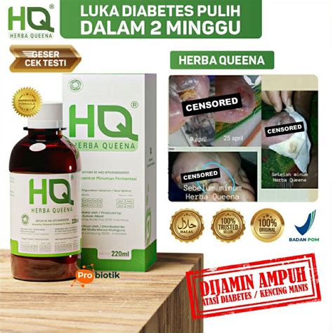 Jual Obat Diabetes Paling Ampuh Kencing Manis Luka Basah Diabet Herbal