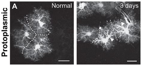 Normal And Reactive Protoplasmic Astrocytes In The Cortex Protoplasmic