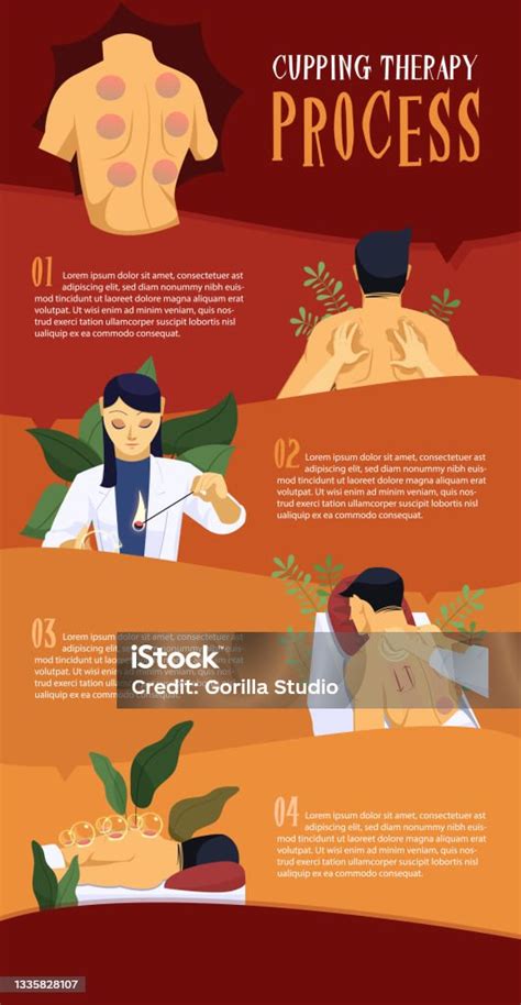 proses terapi bekam ilustrasi stok  gambar  pengobatan