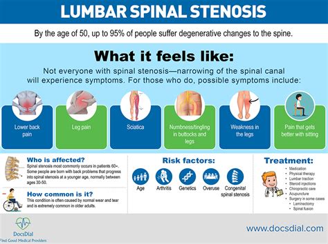 Lumbar spinal stenosis – Gaurav Abbi