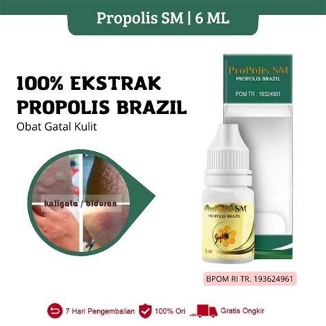 Jual Propolis Sm Obat Oles Gatal Pada Kulit Di Seluruh Tubuh Muncul