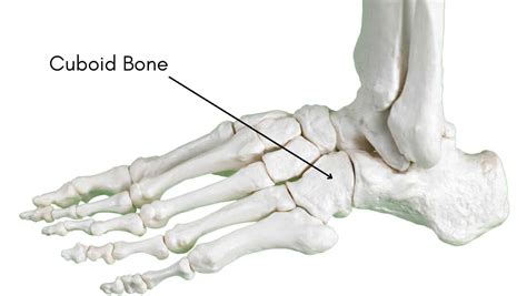 Cuboid Fracture Cuboid Bone Fracture Symptoms And Treatment