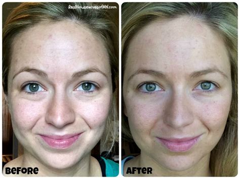 My Nerium Experience Complete With Before And After Photos Real