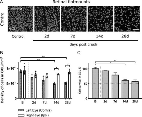 Classification Of Cell Loss In Ganglion Cell Layer Gcl Of Retina