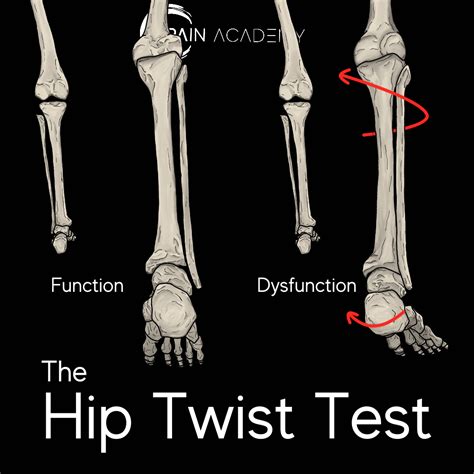 The Hip Twist Pain Academy