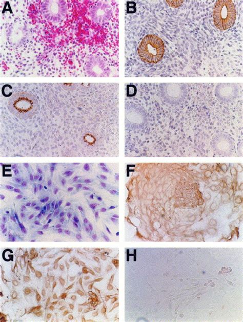 Vectorial Secretion Of Vascular Endothelial Growth Factor By Polarized