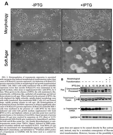 Downregulation of tropomyosin expression is associated with oncogenic ...