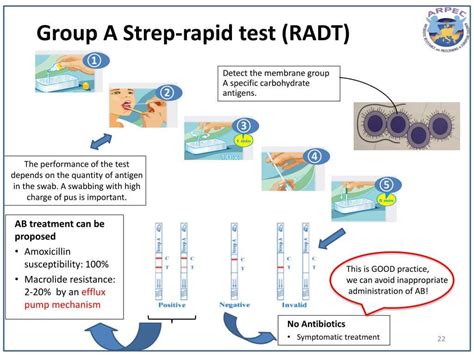 Covid 19 Tests RT PCR Rapid Antigen Test Serological Test PMF IAS