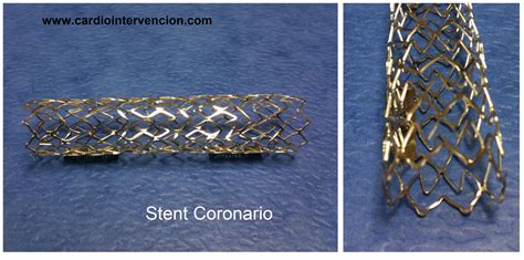 Stent Coronarios