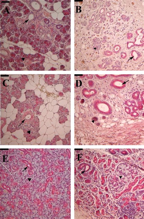 Isolation And Characterization Of Human Salivary Gland Cells For Stem