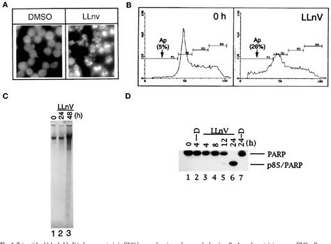 Figure From Proteasome Inhibition Leads To Significant Reduction Of