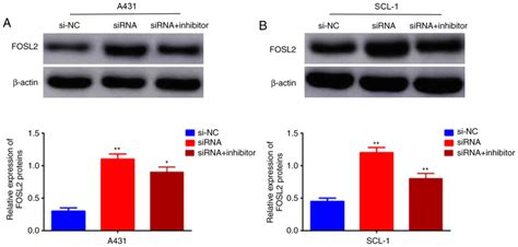 Silencing Circrna May Inhibit Cutaneous Squamous Cell Carcinoma