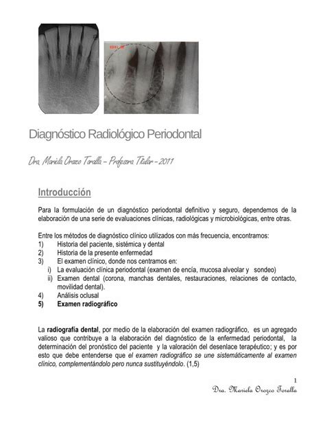 Pdf Diagn Stico Radiol Gico Periodontal Dra Pdf Fileciertos Signos