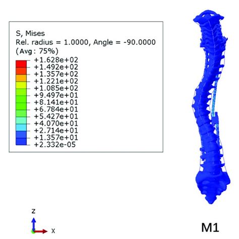 Stress Nephogram Of M1 Model Download Scientific Diagram