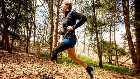 Running With A Prosthetic Leg: Sciatica Clinic