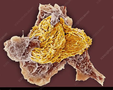 Macrophage Engulfing Tb Bacteria Sem Stock Image C