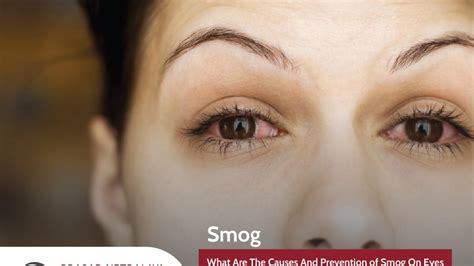 7 Effects Of Smog On The Eyes Prasad Netralaya