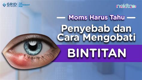 Penyebab Dan Cara Mengobati Bintitan Solusi Terbaik Untuk Mengatasinya