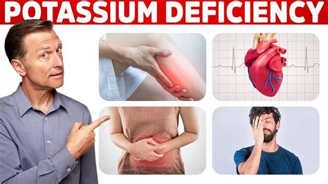 Low Potassium Signs Symptoms Causes And Treatment