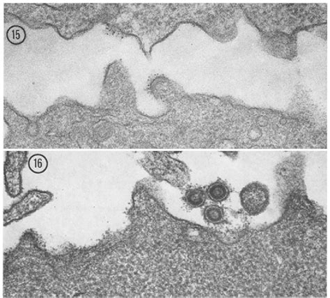 Figure 15 From Viral And Cellular Surface Antigens Of Murine Leukemias