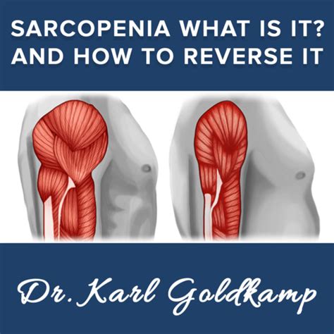 164 Sarcopenia What Is It And How To Reverse It Keto Naturopath