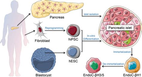 Frontiers In Vitro Beta Cell Killing Models Using Immune Cells And