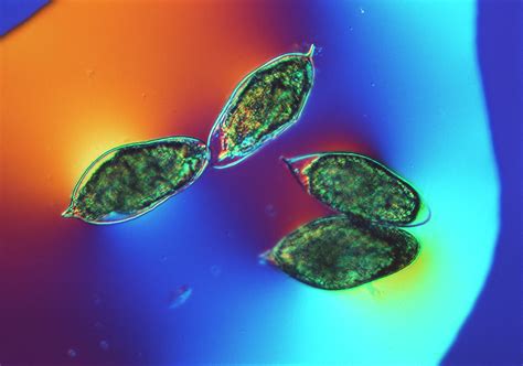 Schistosome Eggs #1 by Science Photo Library 