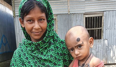 Washus Child Malnutrition Therapy Undergoes Global Trials Mirage News