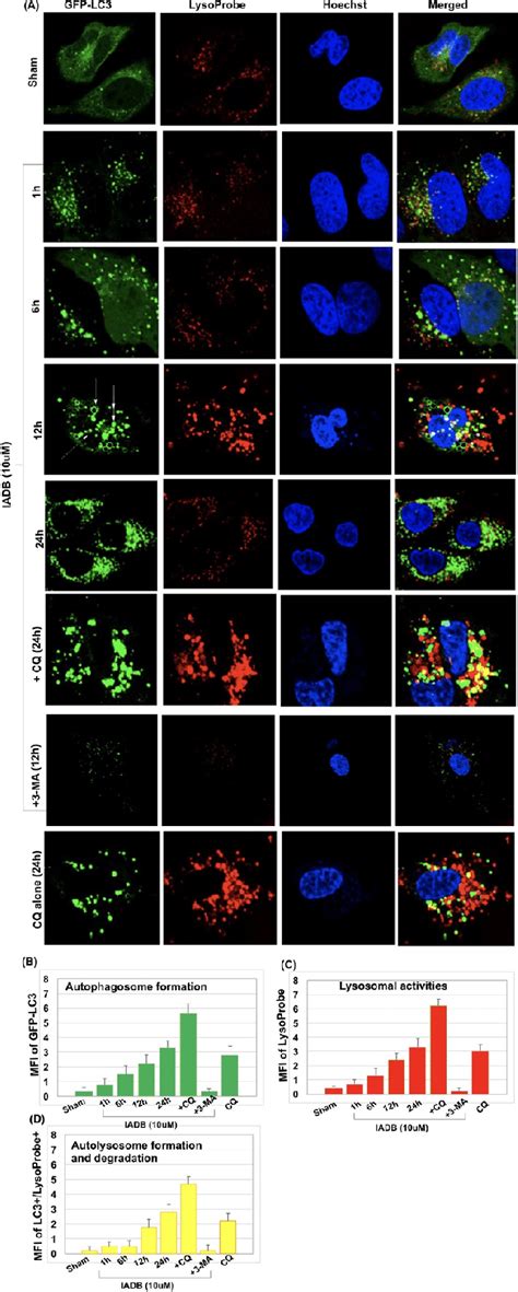 IADB Enhances Autophagic Flux In GFP LC3 Stably Transfected HeLa Cells