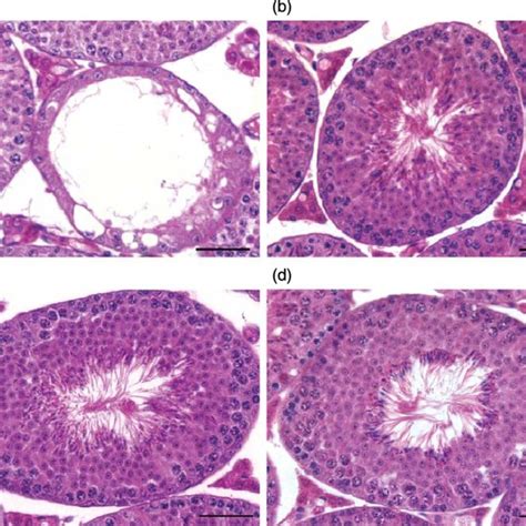 The Total Number Of A Leydig Cells And B Sertoli Cells Per Testis