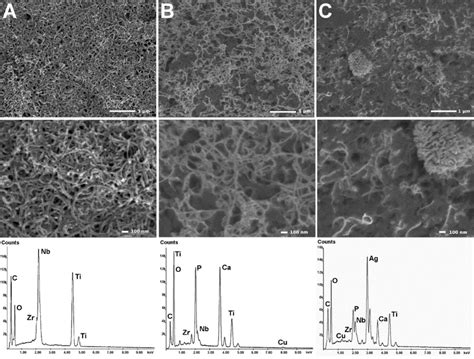 SEM Surface Topography With The Energy Dispersive Spectrometer EDS