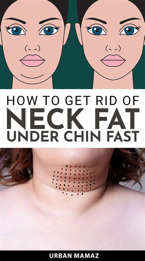 How To Get Rid Of Neck Fat Neck Fat Neck Fat Exercises Double Chin Exercises