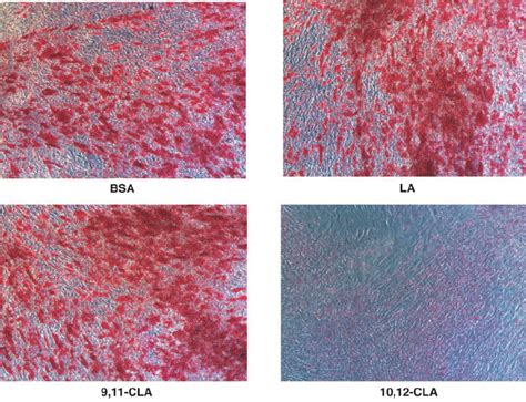 Trans Cis Conjugated Linoleic Acid Cla Decreases Lipid