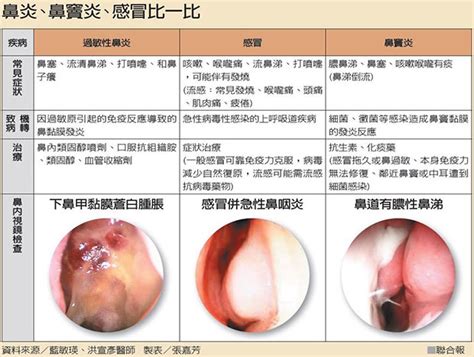 鼻過敏、鼻竇炎、感冒分不清醫師：應對症治療｜天下雜誌