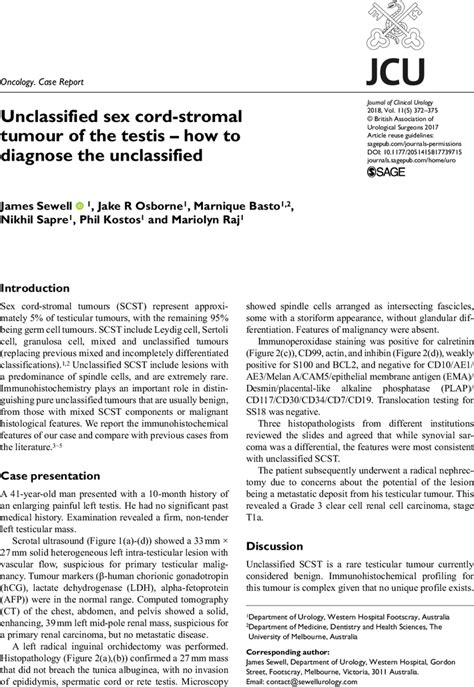 Unclassified Sex Cord Stromal Tumour Of The Testis How To Diagnose