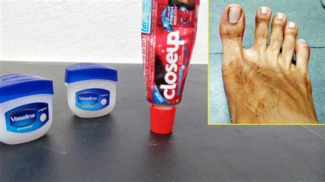 Vaseline And Closeup Gel Toothpaste Life Hacks Feet Whitening Techniques