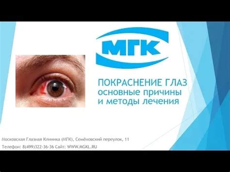 Причины, симптомы, капли для глаз от покраснения глаз. Как убрать ...