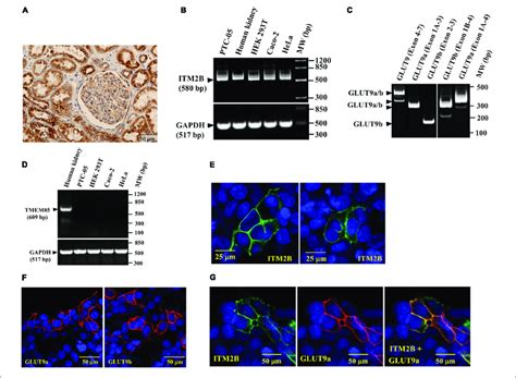 Itm2b And Slc2a9 Gene Expression In Human Renal Proximal Tubule