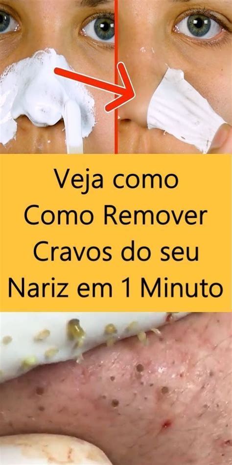 Receita Simples Para Remover Cravos Do Nariz Em Como Remover