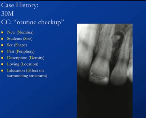 Mixed Bone Lesions Flashcards Quizlet