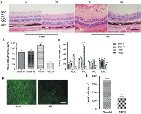 Rir Related Insults On Retinal Morphology And Rgcs Survival A