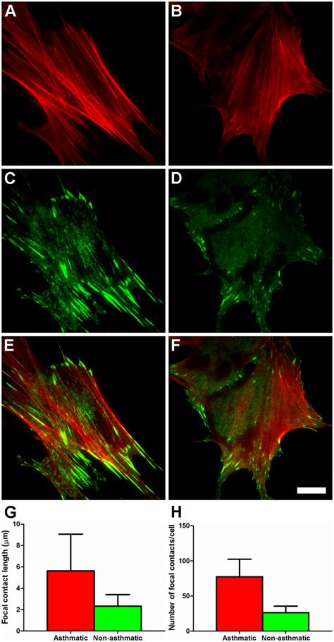 Actin Cytoskeleton Organization In As And Na Hbfs Analyzed By