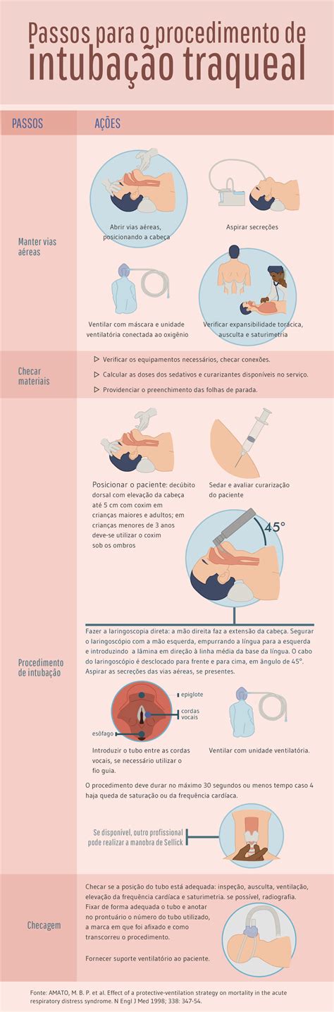 Passos Para O Procedimento De Intuba O Traqueal Infogr Fico